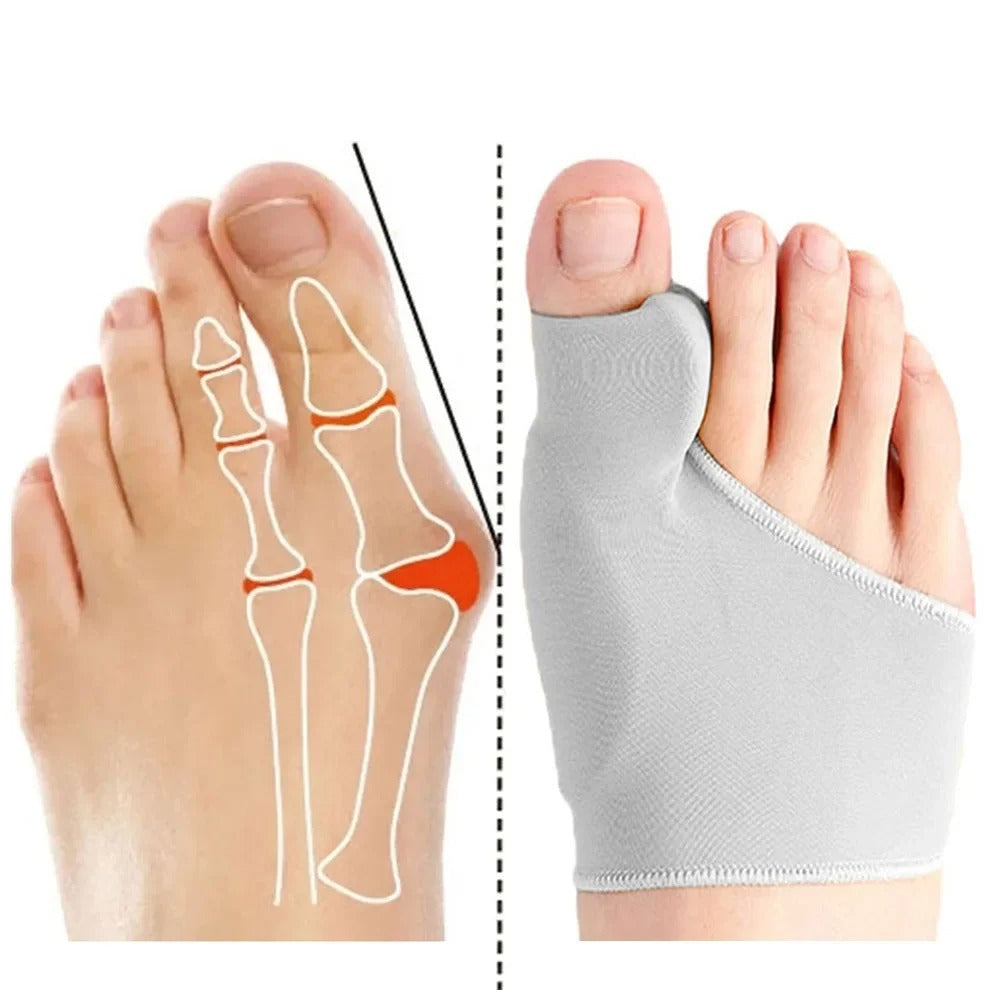 "Effektive Hallux Korrektur-Orthesen"